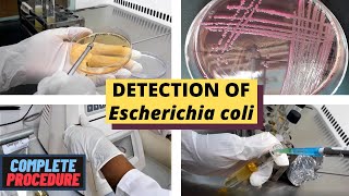 Detection of Escherichia coli E coliA Complete Procedure ISO 93081 amp ISO 16649 [upl. by Adyl]