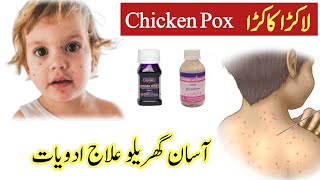 Chickenpox treatment Chickenpox medicine Chickenpox ke nishan chickenpoxkikharish akralakra [upl. by Notlrak]