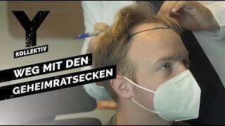 Haartransplantation in der Türkei  Schönheitsoperationen bei Männern  YKollektiv [upl. by Lhamaj]