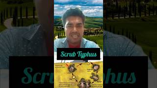 Scrub typhus se kese bache  Scrub typhus kya hai shorts shortsfeed scrubtyphus health [upl. by Noeruat]