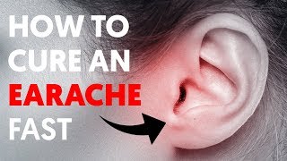 The 5 Quickest Way to Relieve Earaches [upl. by Necaj144]