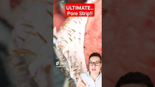 Worlds Biggest PORE STRIP REMOVAL  Proof Pore Strips Work shorts [upl. by Shermy598]