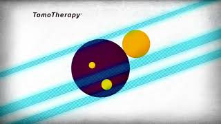 TomoTherapy vs Other Conventional Radiotherapy [upl. by Chapland]