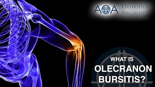 AOA Orthopedic Specialists  Olecranon Bursitis [upl. by Iliram448]