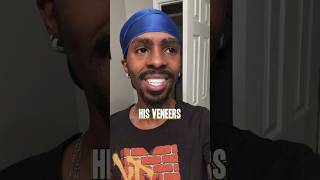 Free veneers gone wrong 😳 shorts veneers [upl. by Khalsa87]