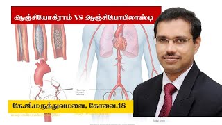 What is a Coronary Angiogram and Angioplasty [upl. by Nerrak]