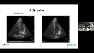 Webinaire Echographie thoracique en Anesthésie [upl. by Jose499]