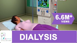 Procedure of DIALYSIS [upl. by Omrelliug]