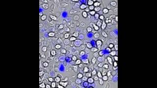 Chemokinesis CCL21  MIT 20109 Laboratory Fundamentals in Biological Engineering Spring 2010 [upl. by Arimaj]