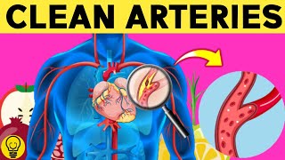 Top 7 Foods that Unclog Arteries Fast and Prevent Heart Attack Naturally [upl. by Nnylorac421]