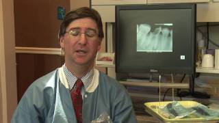 Tooth Abscess  Wisdom Tooth Abscess Symptoms [upl. by Emelda]