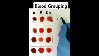 Blood Grouping made easy [upl. by Fasto]