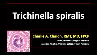 Trichinella spiralis [upl. by Inalaek348]