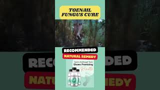 Natural Remedy Toe Nail Fungus Cure onychomycosis howtocurenailfungus fungalinfection [upl. by Haze631]