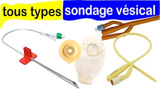 Tout sur les sondes urinaires  Types et Utilisations [upl. by Ennairrac920]