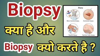 बायोप्सी क्या होती है  बायोप्सी क्यों करते हैं  biopsy kya hoti hai biopsy kya hai  BIOPSY [upl. by Nedia]