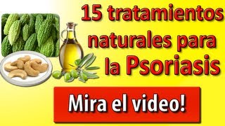 Psoriasis Tratamiento  15 Tratamientos Para La Psoriasis PARTE I [upl. by Nikita]