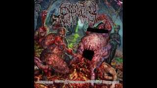 Epicardiectomy  Ulcerous Cadaveric Decrepitation [upl. by Seed468]