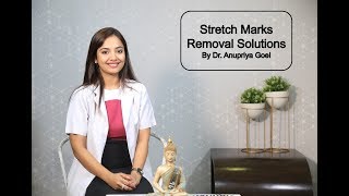 Stretch Marks Removal Solutions By Dr Anupriya Goel [upl. by Kathi]