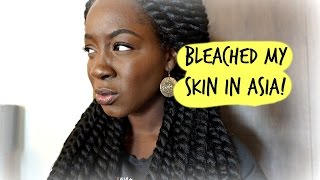 I Bleached My Skin While In Asia [upl. by Odlamur]