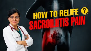 Sacroiliitis का इलाज  IPSC Hospital  Sacroiliitis health [upl. by Chenee910]