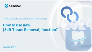 New Soft tissue removal functionAlliedstar IOS [upl. by Ettezyl568]