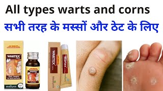 Wartex drop Wartex Cream Homeopathic medicine for Warts and corns सभी तरह के मस्सों और ठेट के लिए।। [upl. by Demodena]