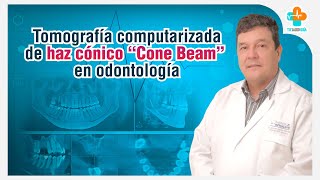 Tomografía computarizada de haz cónico quotCone Beamquot en odontología  Tu Salud Guía [upl. by Ycaj80]