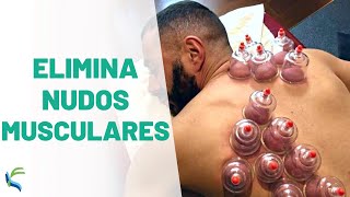 CONTRACTURA muscular 😥 tratamiento con VENTOSAS o CUPPING 🔔 Fisiolution [upl. by Eeslek491]