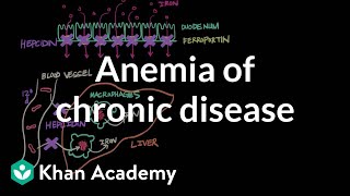 Anemia of chronic disease  Hematologic System Diseases  NCLEXRN  Khan Academy [upl. by Kali]