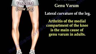 Alignment Of The Lower Limb  Everything You Need To Know  Dr Nabil Ebraheim [upl. by Gerlac]