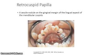 Introduction to Preliminary Diagnosis of Oral Lesions  Oral Pathology Chapter 1 Lecture 3 [upl. by Duwe]