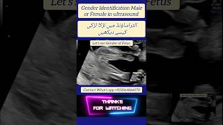 Gender Identification Male or Female in ultrasound [upl. by Oderfliw61]