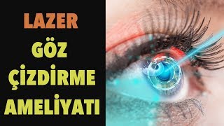 Lazer İle Göz Ameliyatı  Göz Çizdirme ve Sonrası [upl. by Simona84]