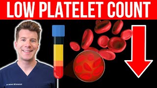 Doctor explains LOW PLATELET COUNT Thrombocytopenia  Causes symptoms and more [upl. by Ozne]