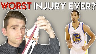 WORST NBA Injury EVER Doctor Explains Shaun Livingston Injury [upl. by Becker]