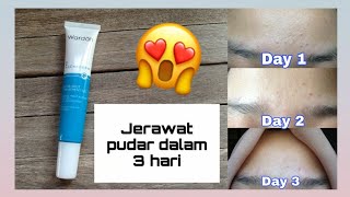 Obat jerawat terampuh 😱😰 Review Wardah acnederm acne spot gel 🗨️  Naili Rifah [upl. by Onder]