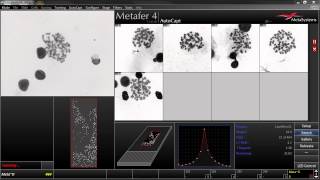 AutoCapt  Automated Image Acquisition with Metafer [upl. by Aisemaj919]