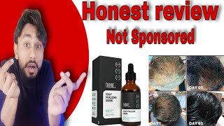 THRIVEco hair serum 20  Honest Review  Use  benefits  side effects [upl. by Eustatius]