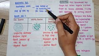 Syphilis treponema pallidum   part 2  Lab Diagnosis  VDRL amp RPR [upl. by Petr613]