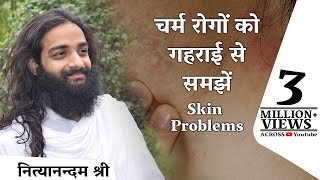 चर्म रोग Skin Problems को समझें ताकि इसका सही इलाज कर सकें  नित्यानंदम श्री [upl. by Sel605]