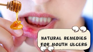 How To Relieve Mouth Ulcers Naturally And Effectively Natural Remedies For Mouth UlcersCanker Sore [upl. by Yrrat984]