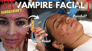 I tried the Vampire Facial 😱 Wait for the RESULTS  Aashi Adani [upl. by Ahseiyk86]