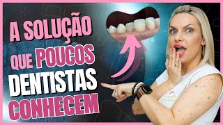 Como Fazer Faceta em Resina em Dente Escurecido  A Solução Que Vai te Surpreender facetasderesina [upl. by Eolcin]