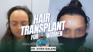 Hair Transplant for Women  Complete Guide  Process Benefits and Expectations [upl. by Prober3]