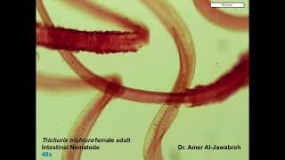 Trichuris trichiura Adult Female Intestinal Nematode [upl. by Ahsilad]