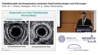 Fisteltherapie als Kooperation zwischen Gastroenterologen und Chirurgen [upl. by Bloomer]