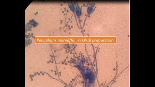 Penicillium marneffei [upl. by Bernette476]