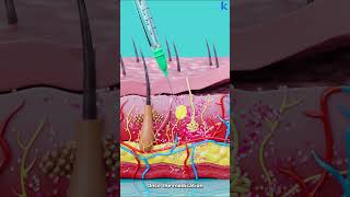 How Subcutaneous Injection Works [upl. by Odiug]