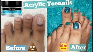 FOOT TRANSFORMATION How I extend my short Toenails using Acrylic without TIP   PEDICURE at Home [upl. by Sielen219]